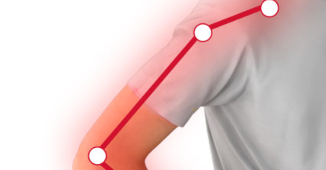 Understanding Arm Pain that is coming from your Neck image