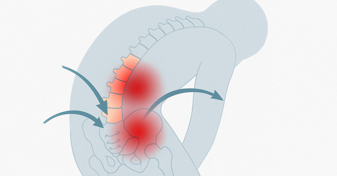 Why Do I Have Back Pain But I Didn’t Do Anything? image